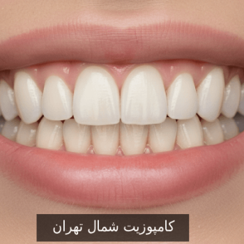 کامپوزیت شمال تهران