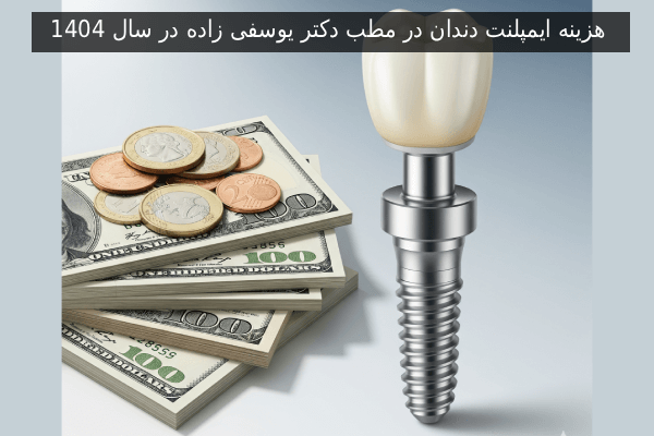 هزینه ایمپلنت دندان در مطب دکتر یوسفی زاده در سال 1404