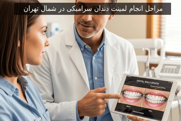 مراحل انجام لمینت دندان سرامیکی در شمال تهران