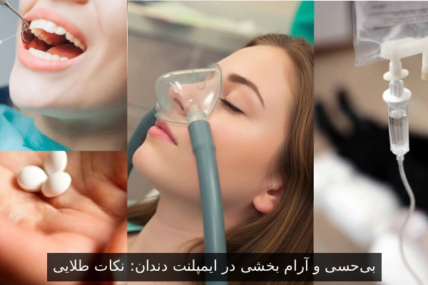 بی‌حسی و آرام‌ بخشی در ایمپلنت دندان: نکات طلایی