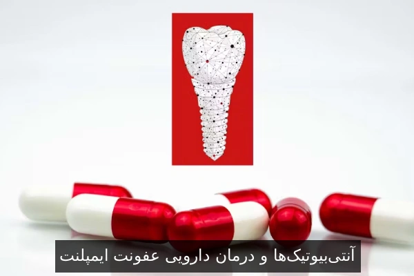 آنتیبیوتیکها و درمان دارویی عفونت ایمپلنت