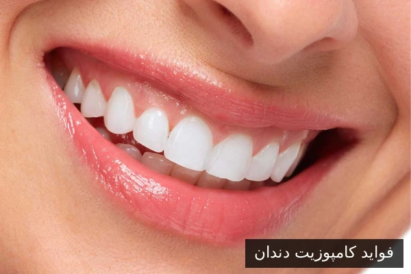 Benefits of Dental Composites