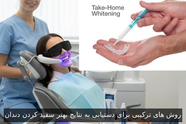 روش های ترکیبی برای دستیابی به نتایج بهتر سفید کردن دندان