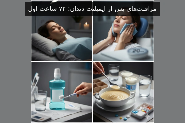 مراقبت‌های پس از ایمپلنت دندان: ۷۲ ساعت اول