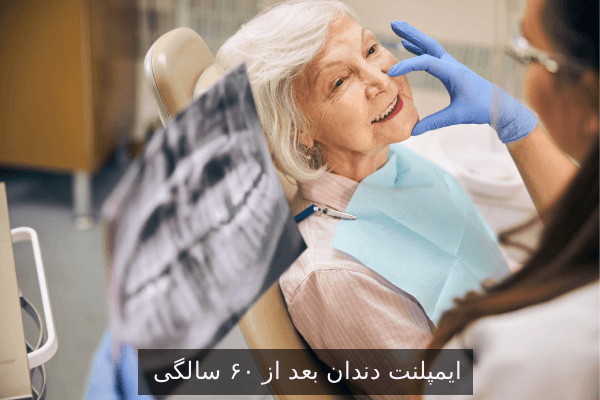 ایمپلنت دندان بعد از ۶۰ سالگی