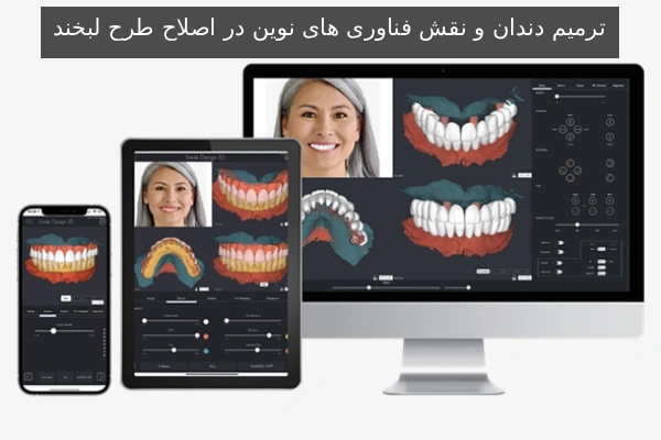 ترمیم دندان و نقش فناوری های نوین در اصلاح طرح لبخند