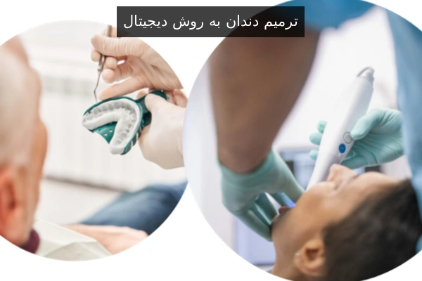ترمیم دندان به روش دیجیتال