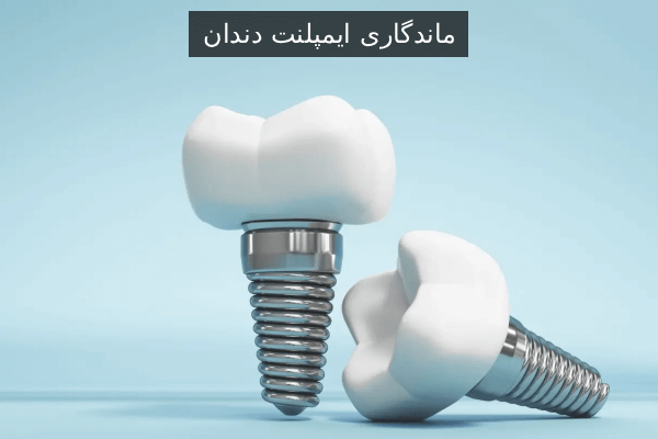 ماندگاری ایمپلنت دندان