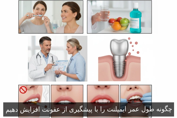 چگونه طول عمر ایمپلنت را با پیشگیری از عفونت افزایش دهیم