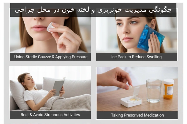 چگونگی مدیریت خونریزی و لخته خون در محل جراحی