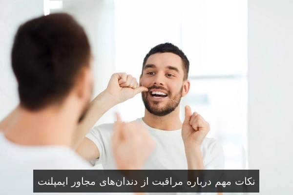 نکات مهم درباره مراقبت از دندانهای مجاور ایمپلنت