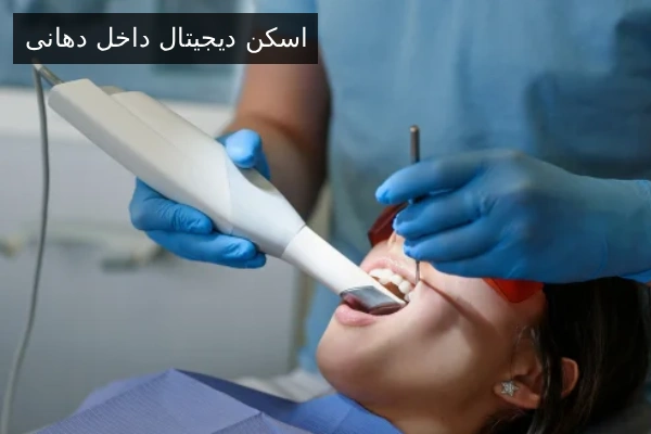 اسکن دیجیتال داخل دهانی