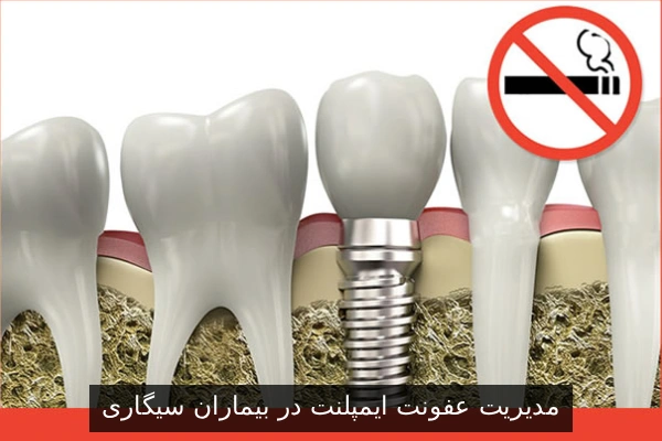 مدیریت عفونت ایمپلنت در بیماران سیگاری