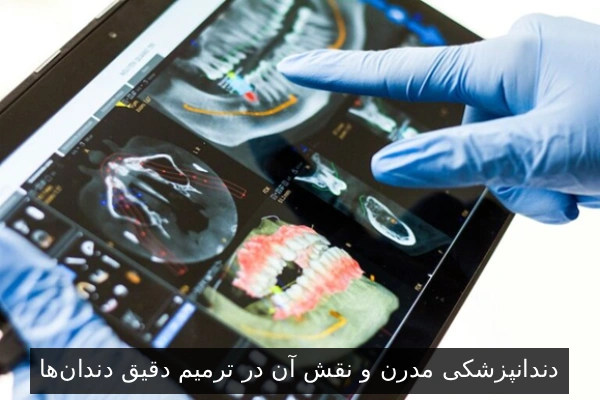 دندانپزشکی مدرن و نقش آن در ترمیم دقیق دندانها