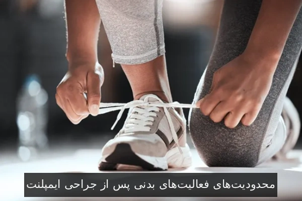 محدودیتهای فعالیتهای بدنی پس از جراحی ایمپلنت