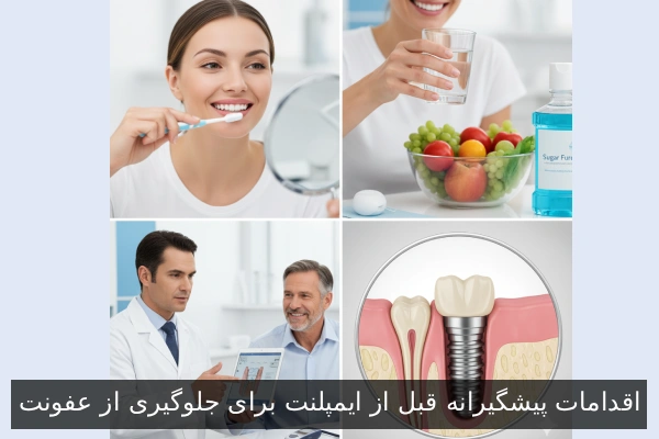 اقدامات پیشگیرانه قبل از ایمپلنت برای جلوگیری از عفونت