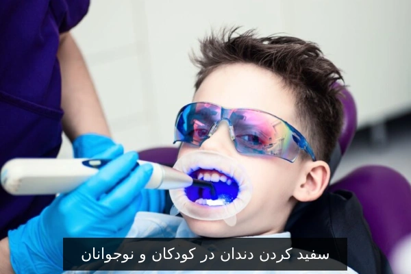 سفید کردن دندان در کودکان و نوجوانان