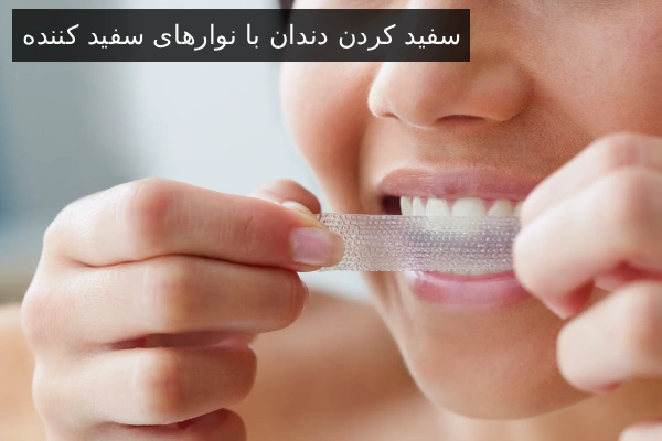 سفید کردن دندان با نوارهای سفید کننده