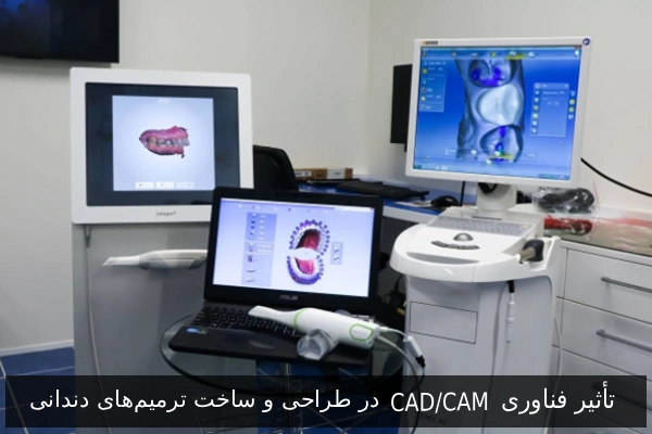 تأثیر فناوری CAD/CAM در طراحی و ساخت ترمیمهای دندانی