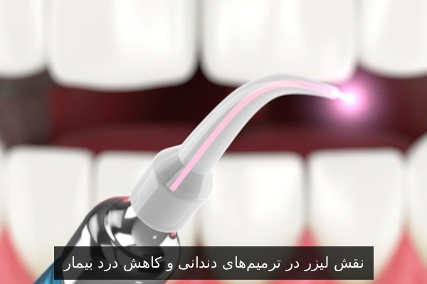 نقش لیزر در ترمیمهای دندانی و کاهش درد بیمار