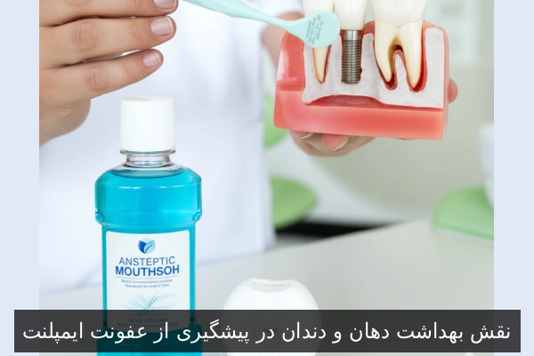 نقش بهداشت دهان و دندان در پیشگیری از عفونت ایمپلنت
