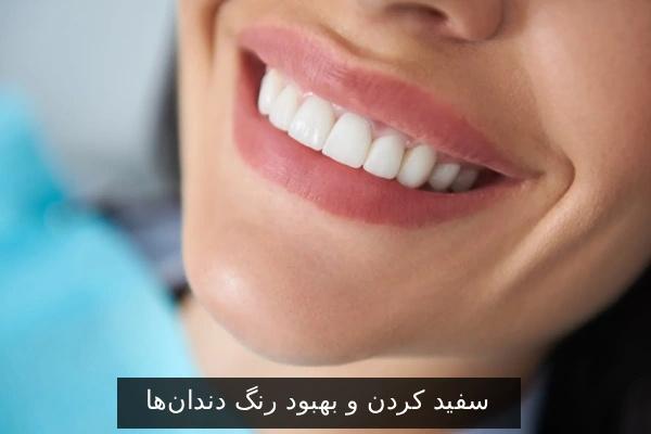 سفید کردن و بهبود رنگ دندانها