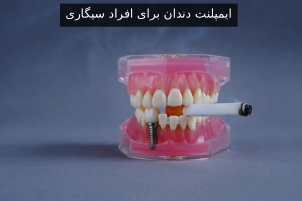 ایمپلنت دندان برای افراد سیگاری