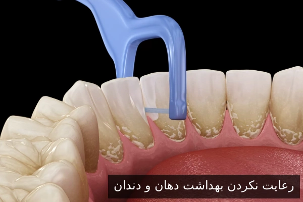 رعایت نکردن بهداشت دهان و دندان