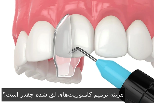 هزینه ترمیم کامپوزیت‌های لق شده چقدر است؟