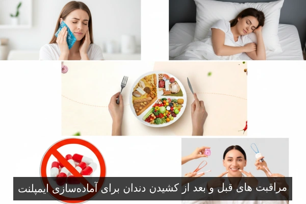 مراقبت‌ های قبل و بعد از کشیدن دندان برای آماده‌سازی ایمپلنت