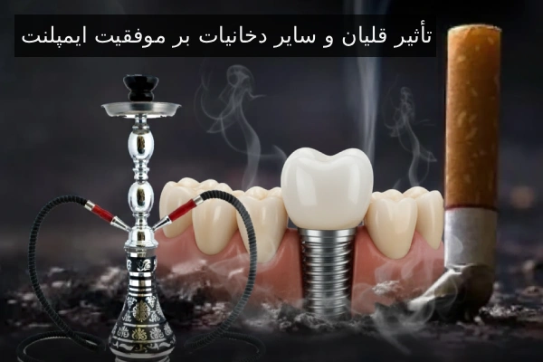 تأثیر قلیان و سایر دخانیات بر موفقیت ایمپلنت
