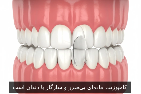 کامپوزیت ماده‌ای بی‌ضرر و سازگار با دندان است