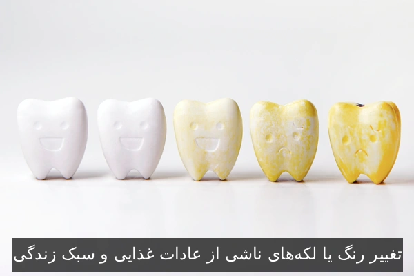 تغییر رنگ یا لکه‌های ناشی از عادات غذایی و سبک زندگی