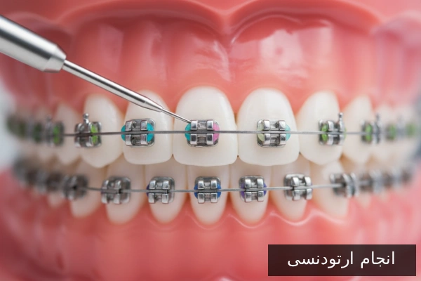 انجام ارتودنسی