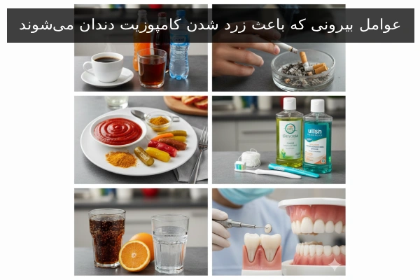 عوامل بیرونی که باعث زرد شدن کامپوزیت دندان می‌شوند
