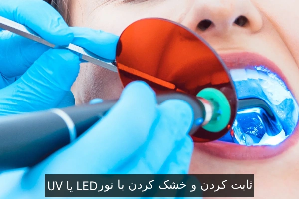 ثابت کردن و خشک کردن با نور UV یا LED