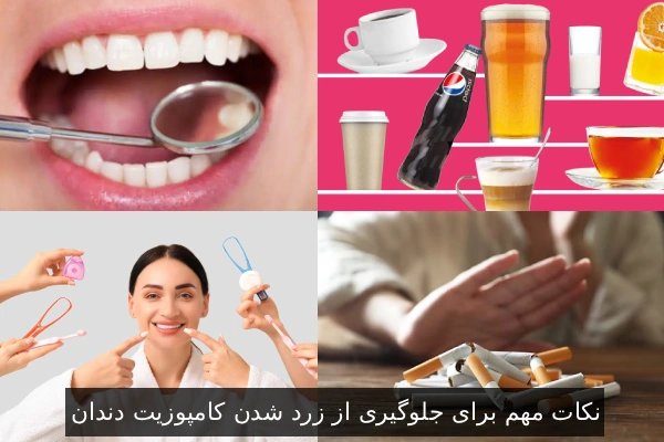 نکات مهم برای جلوگیری از زرد شدن کامپوزیت دندان