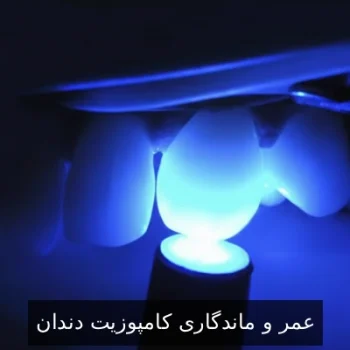 عمر و ماندگاری کامپوزیت دندان