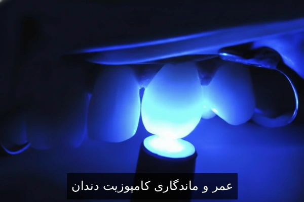 عمر و ماندگاری کامپوزیت دندان