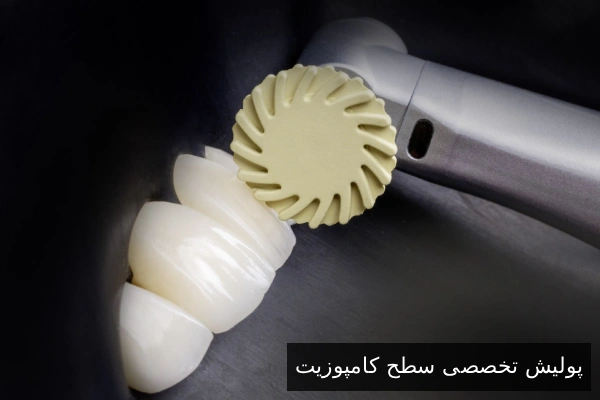 پولیش تخصصی سطح کامپوزیت
