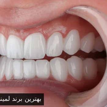 بهترین برند لمینت دندان