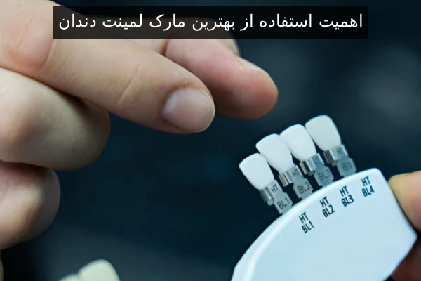 اهمیت استفاده از بهترین مارک لمینت دندان