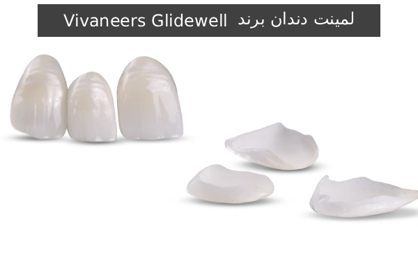 لمینت دندان برند Vivaneers Glidewell